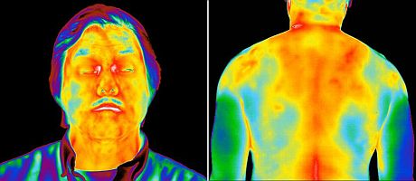 Termogram ludzkiej twarzy i pleców może być pomocny przy diagnozowaniu